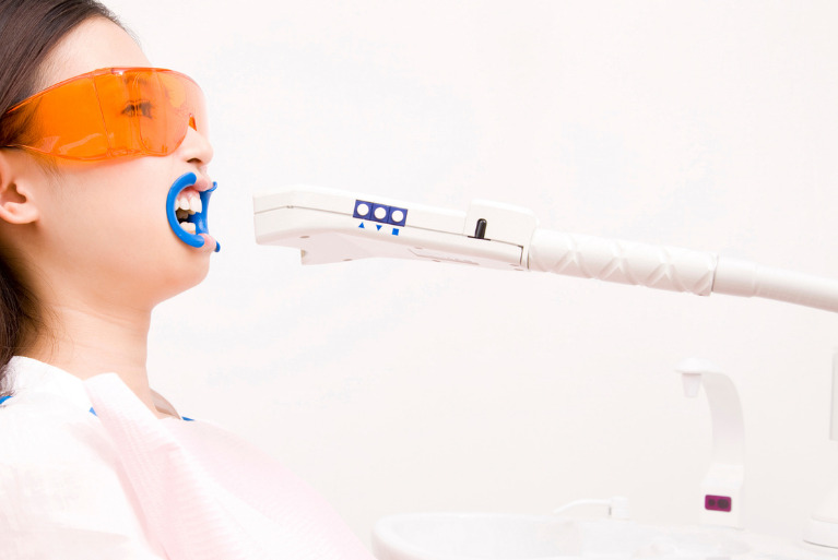 オフィスホワイトニング