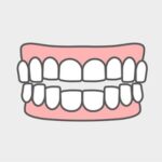 開咬（オープンバイト）