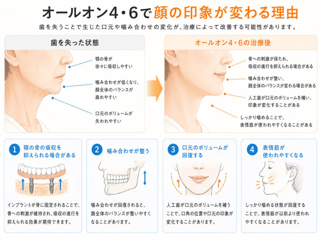 オールオン4・6で顔の印象が変わる理由