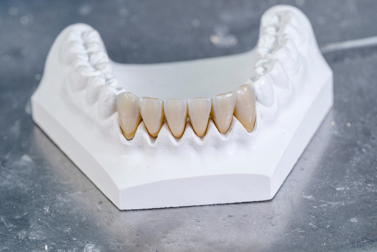 ジルコニアセラミック