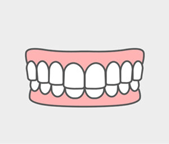 過蓋咬合（ディープバイト）