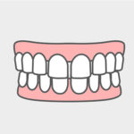 すきっ歯（空隙歯列）