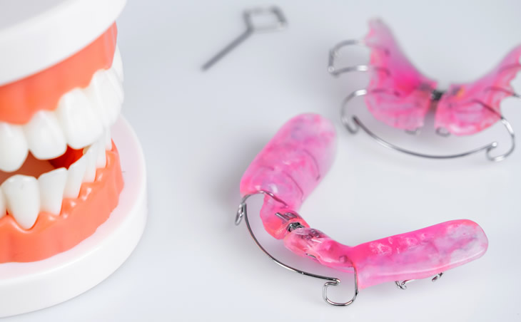 治療完了・保定期間